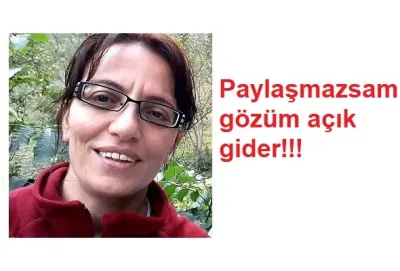 Paylaşmazsam Gözüm Açık Gider