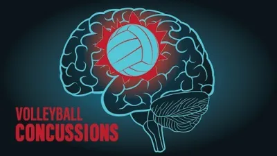Voleybolda beyin sarsıntısı sorunu var